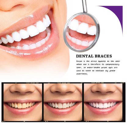 V34 Purple Teeth Whitening Pen – Instant Bright Smile in 2 Minutes